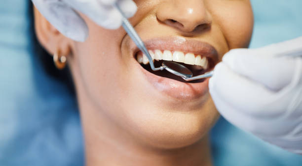 Best Emergency Denture Repair in River Edge, NJ